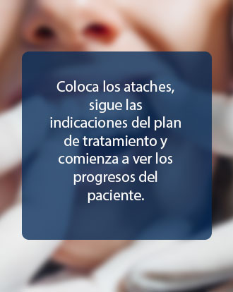 Instalación del Tratamiento — Dentaligner